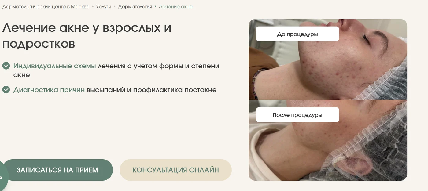 Первый экран страницы услуги клиники: заголовок под запрос, выгоды, фото до и после, запись и онлайн-консультация